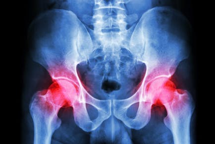 腰痛の原因となる仙腸関節障害とは？症状や治療法について解説！